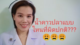 #น้ำคาวปลาหลังคลอดแบบไหนผิดปกติ??