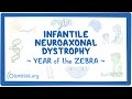 Infantile neuroaxonal dystrophy (Year of the Zebra)