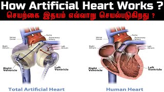 How artificial heart works ? செயற்கை இதயம் எவ்வாறு செயல்படுகிறது ? | Tamil | SYNCARDIA | CARDIOLOGY