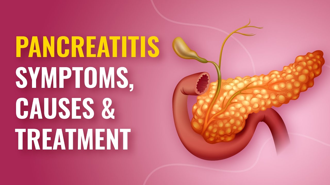 Pancreatitis Symptoms, Causes, Types & Treatment | MFine - YouTube