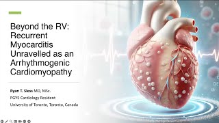 Beyond the RV: Recurrent Myocarditis Unravelled as an Arrhythmogenic Cardiomyopathy