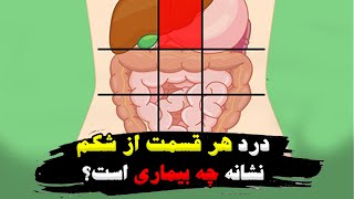 درد در هر نقطه از شکم نشانه چیست؟