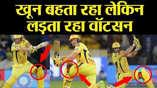 IPL 2019 Final: Shane Watson played with bleeding knee during CSK vs MI Finale | वनइंडिया हिंदी