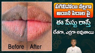 How to Treat Dark Lips | Get Soft Red Lips | Reduces Dry and Chapped Lips | Dr.Manthena's Beauty Tip