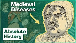 The Grim Realities Of Life Before Medicine | Medieval Dead | Absolute History