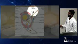 Approach to the Basilar Apex - Akshal S. Patel, MD