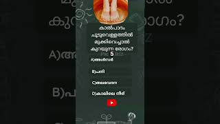 ഇത് നിങ്ങൾക്കറിയാമോ? #quiz #psctricks #trending #viral #psclearningtricks