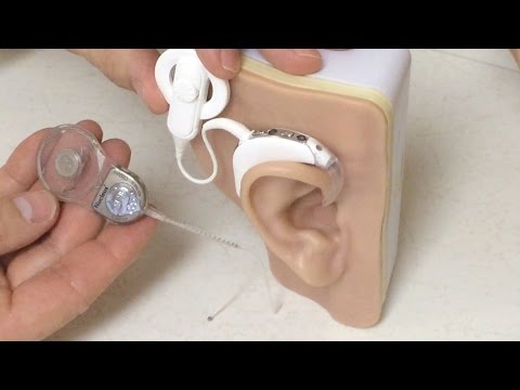What is a hybrid cochlear implant?