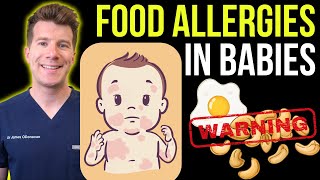 Doctor explains FOOD ALLERGIES WHEN WEANING BABIES