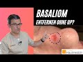 Basaliom entfernen ohne OP? | Dr. Kasten Hautmedizin in Mainz