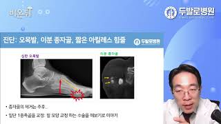 (발톡_비온뒤) 엄지발가락 바닥 통증, 종자골염의 진단과 치료,족부전문의 김지범