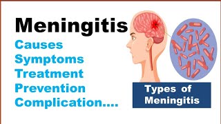 Meningitis | Types, Causes, Symptoms, Treatment