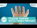 Waspadai Telapak Tangan Gatal Bisa Jadi Tanda Penyakit Serius: Eksim hingga Diabetes Mellitus