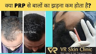 PRP Therapy for Hair Growth (Hindi) | VR Skin Clinic | Dr Vineet Kumar | Bikaner | Hair treatment