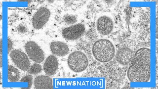 Monkeypox: What CDC's new alert level means | NewsNation Prime