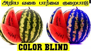 லட்சத்தில் ஒருவருக்கு ஏற்படும் பார்வை குறைபாடு  | Color blind | 5 Min Videos