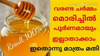 വരണ്ട ചർമ്മം മാറി ബേബി സോഫ്റ്റ്‌ ചർമ്മം l 100% RESULT I 100% NATURAL I WINTER DRY SKIN CARE I DIY