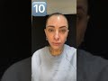 בוטוקס ❤️ בוטוקס אסתטיקה הזרקות botox אסתטיקה לפרטים 0586606042