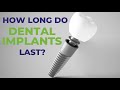 How Long Do Dental Implants Last | Elite Dental Group Singapore | +65 6333 4456