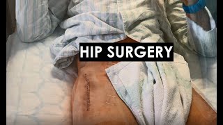 Bilateral Hip Replacement Surgery Video - Dr. Kavcic
