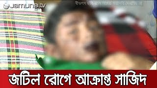 ওষুধের পার্শ্বপ্রতিক্রিয়া কতটা ভয়াবহ, টের পাচ্ছে সাজিদ! | Jamuna TV