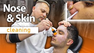 SENSATIONAL ASMR THERAPY - Nose \u0026 Skin Cleaning