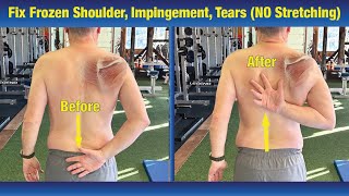 INCREDIBLE way to Fix Frozen Shoulder & Impingement - (NO Stretching or PT Exercises)