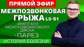 Межпозвонковая грыжа l5-s1. Имплант межпозвонкового диска. Парез.