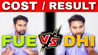 Why DHI Hair Transplant Results are Still Better Than FUE Hair Transplant || Hair Transplant QnA