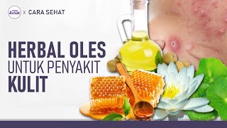 Resep Herbal Oles untuk Atasi Bisul dan Jerawat | Hidup Sehat tvOne