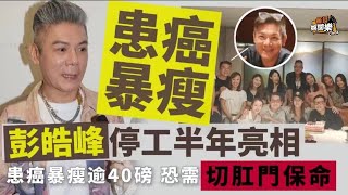 確診直腸癌！TVB「御用惡人」暴瘦亮相，停工半年恐需切肛門保命