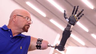 Rising to the Challenge: Miami - Panel Discussion, Revolutionizing Prosthetics
