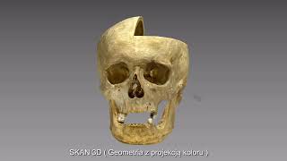 Prezentacja czaszki w technologii cyfrowej 3D (komentarz z zakresu medycyny i historii)