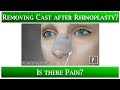 1st Appointment after Rhinoplasty -2 Removing the cast