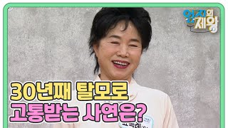 머리카락 잃고 자신감도 잃고 스트레스만 쌓인다! 30년째 탈모로 고통받는 사연은? MBN 230516 방송