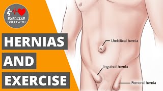 Is exercising with a hernia safe?