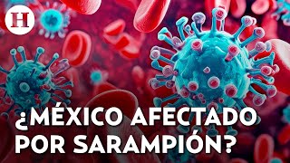 ¡Sarampión se extiende en América! Autoridades emiten alerta por aumento de casos