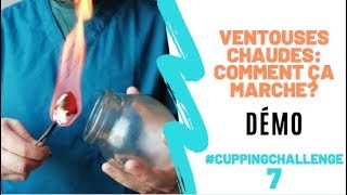 Les ventouses chaudes : Mode d'emploi! [DÉMO] Cupping therapy/Hijama