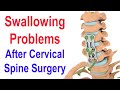 Swallowing Problems after Cervical Spine Surgery (ACDF)