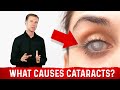 What Causes Cataracts? – Dr. Berg