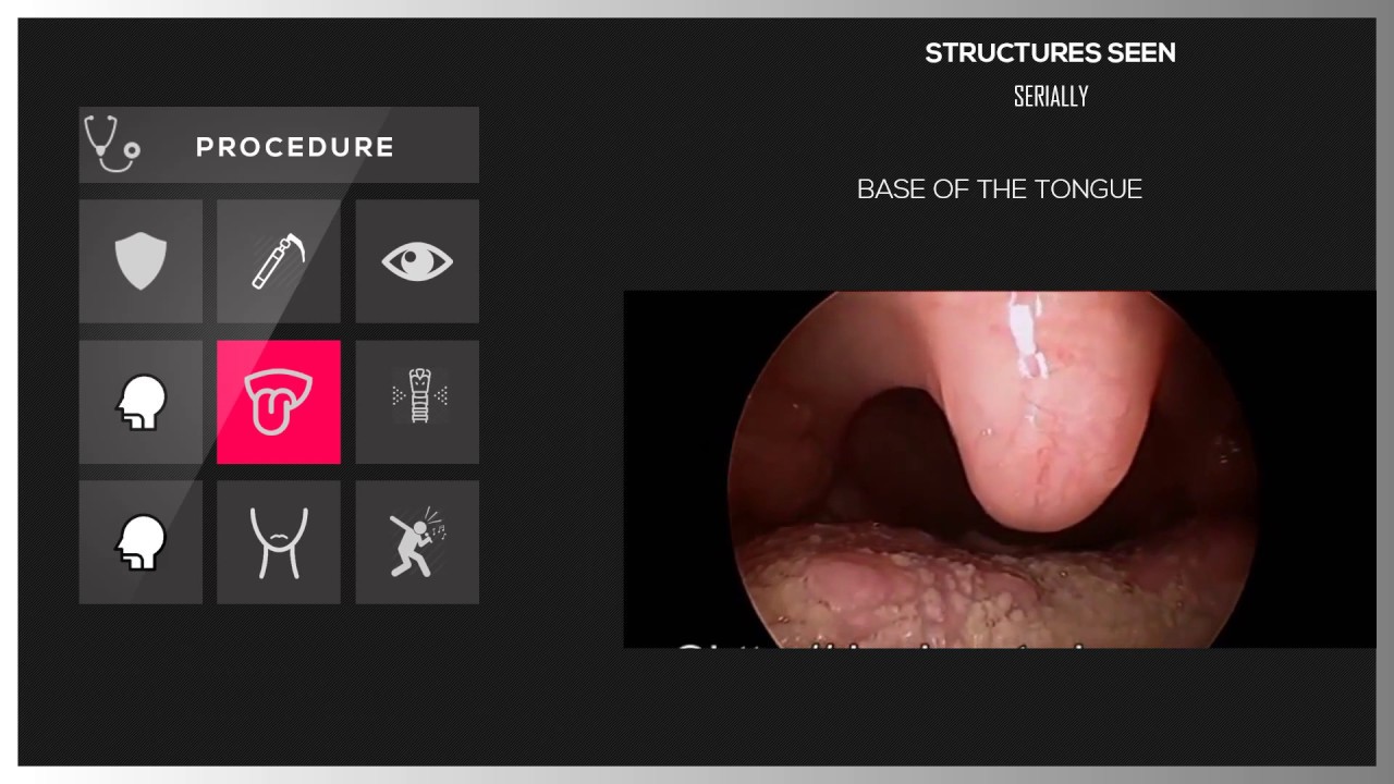 DIRECT LARYNGOSCOPY - YouTube