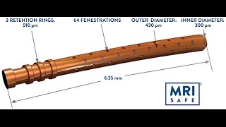 CyPass Micro-Stent insertion technique