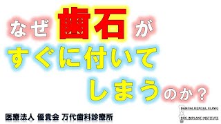 群馬 前橋 高崎 歯科 歯周病 万代歯科 『 なぜ歯石がすぐに付いてしまうのか？ 』