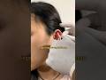 Tindikan baru gak boleh lembab! HELIX PIERCING