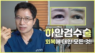 하안검 회복기간에 대한 모든 것! ABC성형외과가 싹 다 알려드려요~