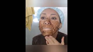 ESFOLIANTE CASEIRO para o rosto - Adeus manchas - Esfoliação facial com CAFÉ #shorts