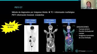 Modalidades avanzadas de imagen en oncología mamaria