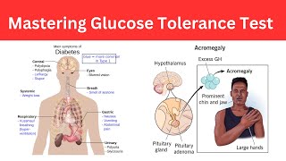 Mastering the Oral Glucose Tolerance Test: A Comprehensive Guide