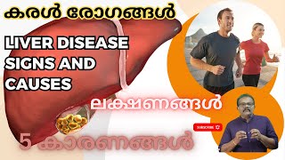 കരൾ രോഗങ്ങൾ കാരണങ്ങളും ലക്ഷണങ്ങളും -LIVER DISEASES 5 CAUSES AND SIGNS