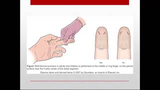 Capillary Punctures